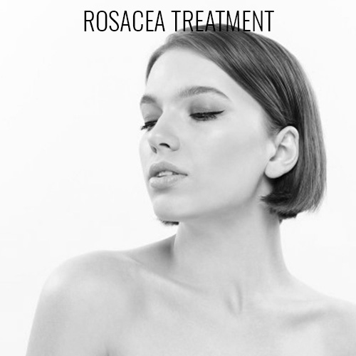 Rosacea Treatment